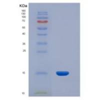 人抑制素βA(INHbA)重组蛋白