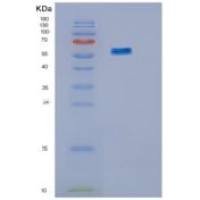 人肌苷-5'-单磷酸脱氢酶2(IMPDH2)重组蛋白