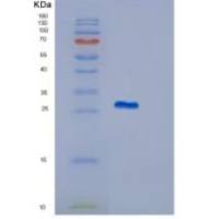 人ITGB1BP3重组蛋白