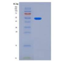 人KRT14重组蛋白