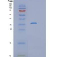 人白细胞介素-1受体1型重组蛋白