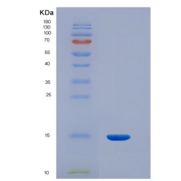人抑制素βC(INHbC)重组蛋白