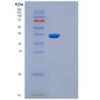 小鼠白介素5受体α(IL5Ra)重组蛋白