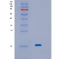 人KCNMB3重组蛋白