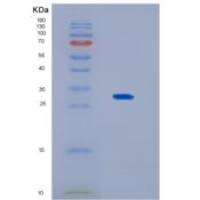 人KCTD15重组蛋白