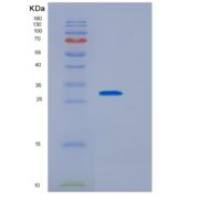 人白介素2受体γ(IL2Rg)多克隆抗体