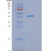 人异戊酰辅酶A脱氢酶(IVD)重组蛋白