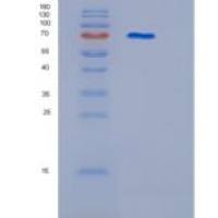 人ITGB2重组蛋白