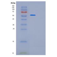 人KRT8重组蛋白