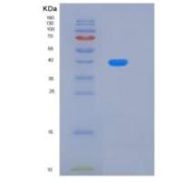 人KLHDC8B重组蛋白