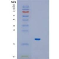 人Interferon-α 1重组蛋白