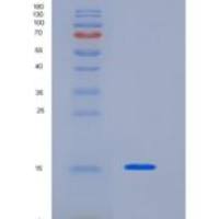 人KHDC1L重组蛋白