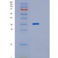 人ING2重组蛋白
