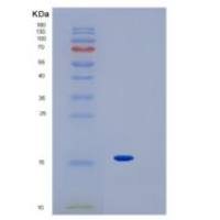 人IL1F10重组蛋白