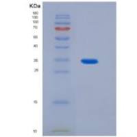 人白介素23(IL23)重组蛋白