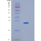 人杀伤细胞免疫球蛋白样受体2DL3(KIR2DL3)p58 KIR重组蛋白