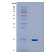 人抑制素βC(INHbC)重组蛋白
