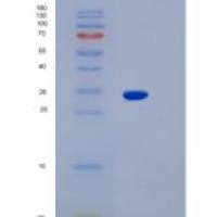 人Kv通道相互作用蛋白3(KCNIP3)重组蛋白