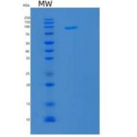 人亲核素β(KPNb1)重组蛋白