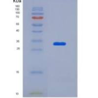 人酮己糖激酶(Ketohexokinase)重组蛋白