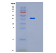 人琪雅13号（KIAA0513）重组蛋白