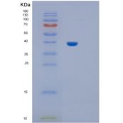 大鼠IL11ra1重组蛋白
