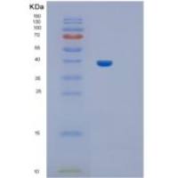 大鼠IL11ra1重组蛋白