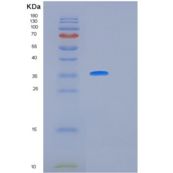 人白介素12(IL12)重组蛋白