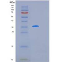 人白介素12(IL12)重组蛋白