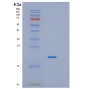 人IL36RN重组蛋白