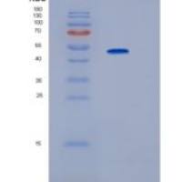 人IP6K2重组蛋白
