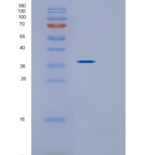 小鼠Impad1重组蛋白