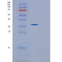 小鼠Impad1重组蛋白