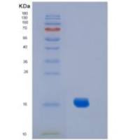 小鼠白介素2(IL2)C160S重组蛋白