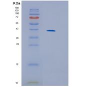 人白介素13受体α2(IL13Ra2)重组蛋白产品图
