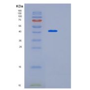 人琪雅13号（KIAA0513）重组蛋白