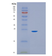 小鼠白介素6(IL6)重组蛋白