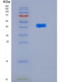 人DNA/RNA结合蛋白kin 17（kin 17）重组蛋白