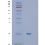 人干扰素调节因子2(IRF2)重组蛋白
