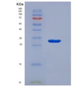 人激肽释放酶10(KLK10)重组蛋白