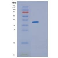 人JSRP1重组蛋白