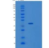 人激肽释放酶13(KLK13)重组蛋白