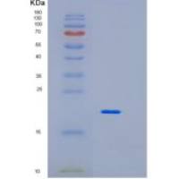 人白介素10(IL10)重组蛋白重组蛋白