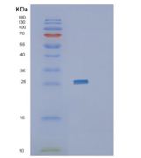 人连接附着分子3(JAM3)重组蛋白