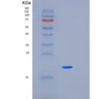 人杀伤细胞凝集素样受体亚家族K成员1(KLRK1)重组蛋白