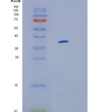 人白介素13受体α1(IL13Ra1)重组蛋白