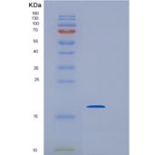 大肠杆菌干扰素a-2b（24-188）人重组蛋白