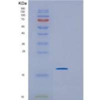 大肠杆菌干扰素a-2b（24-188）人重组蛋白