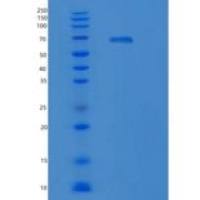 人KRS（赖氨酰色氨酸合成酶）重组蛋白