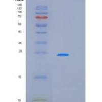 人激肽释放酶11(KLK11)重组蛋白